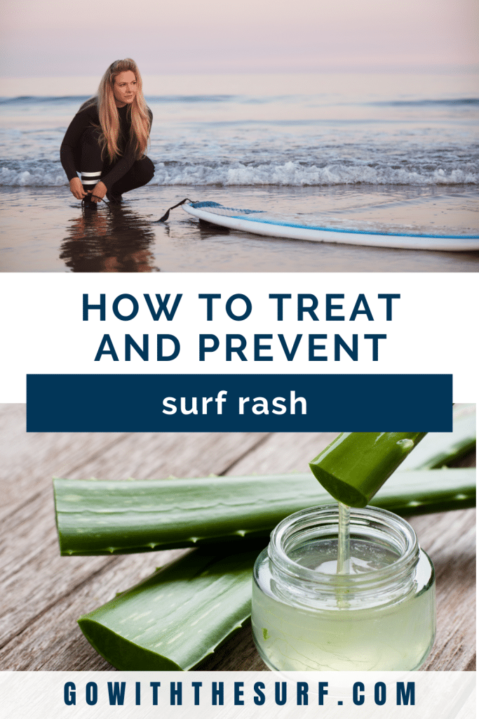 Surfer rash treatment Pin 1